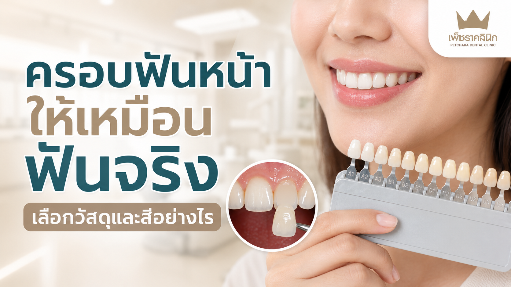 natural-aesthetic-front-dental-crown-material-shade-guide