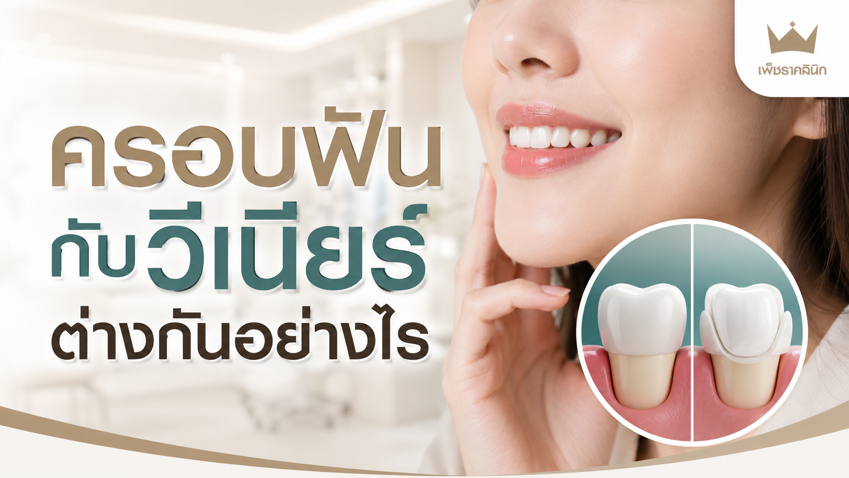 dental-crown-vs-veneer-difference-comparison-guide
