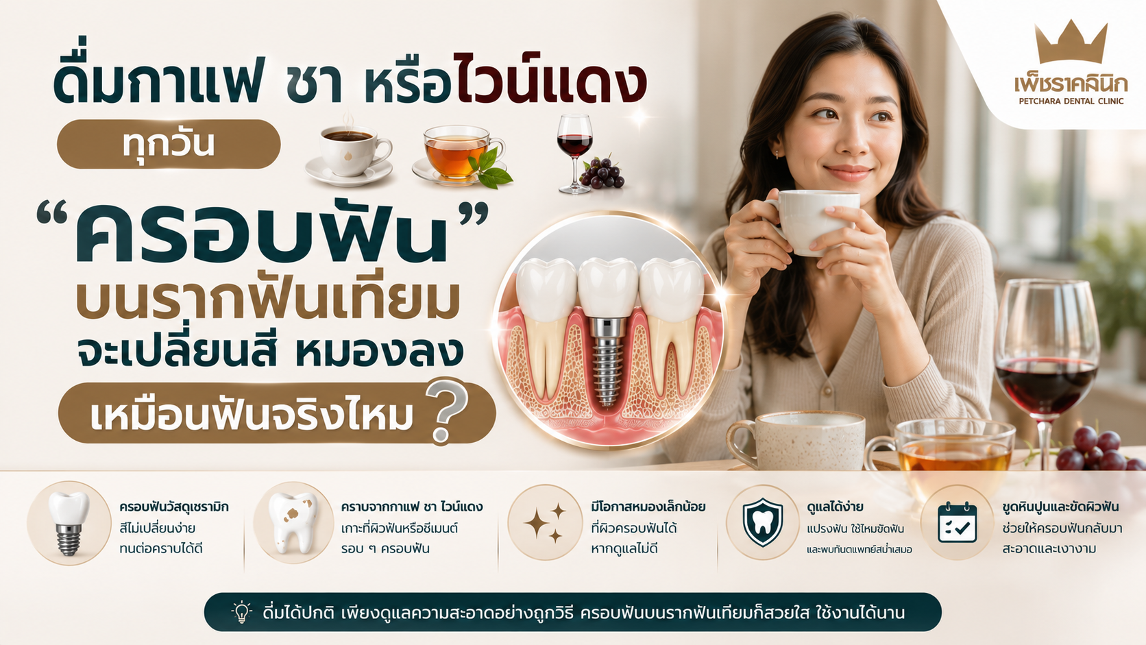 dental-implant-crown-coffee-tea-stain-guide