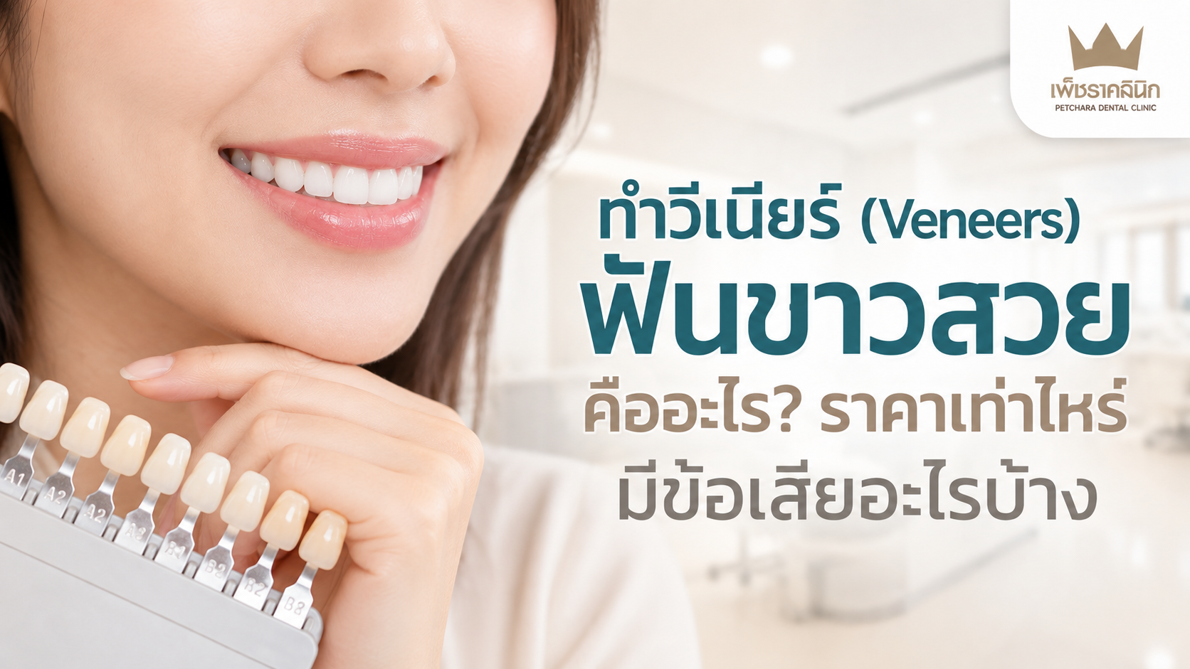 veneers-guide-types-pros-cons-procedure-cost