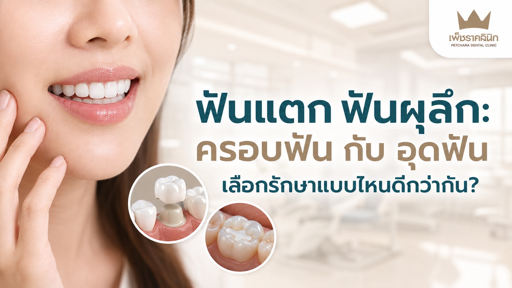 chipped-deep-caries-tooth-filling-vs-crown-comparison-guide