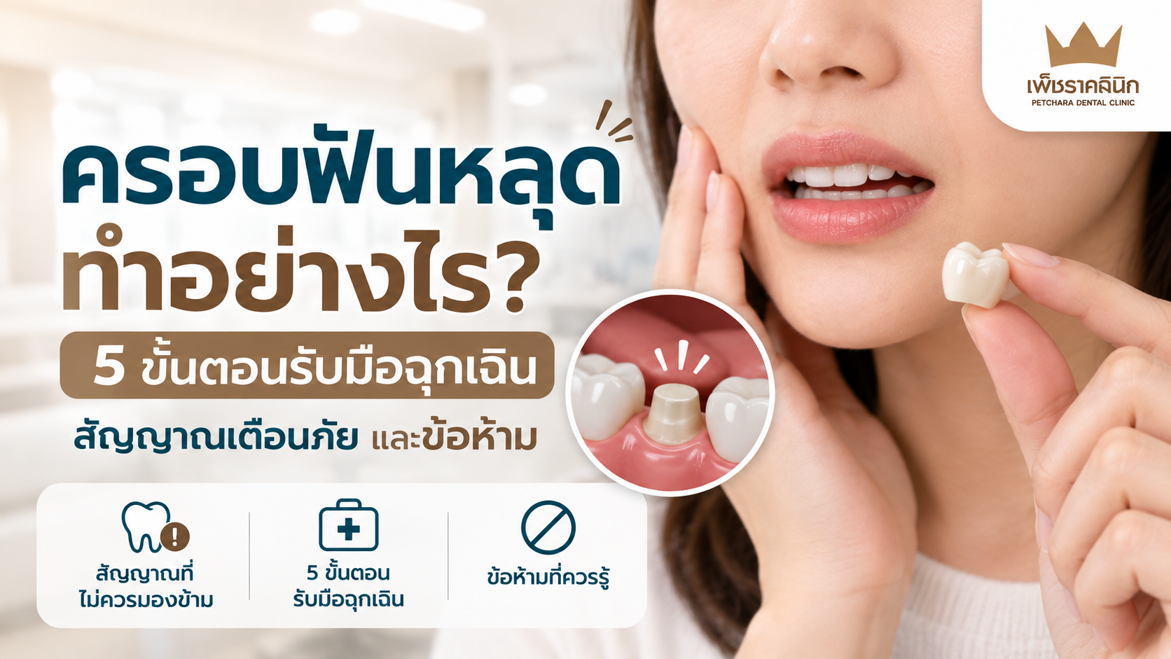 fallen-dental-crown-emergency-action-plan-guide