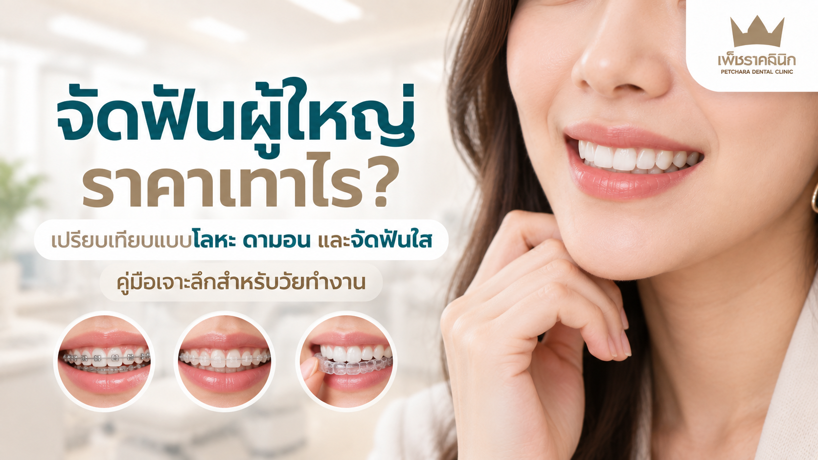 adult-orthodontics-cost-comparison-metal-damon-invisalign-guide