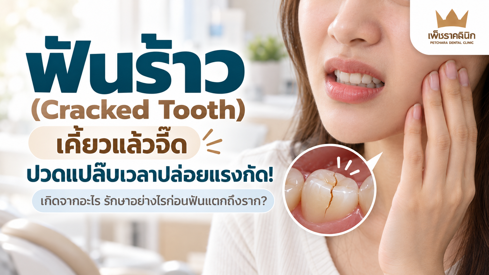 Cracked Tooth