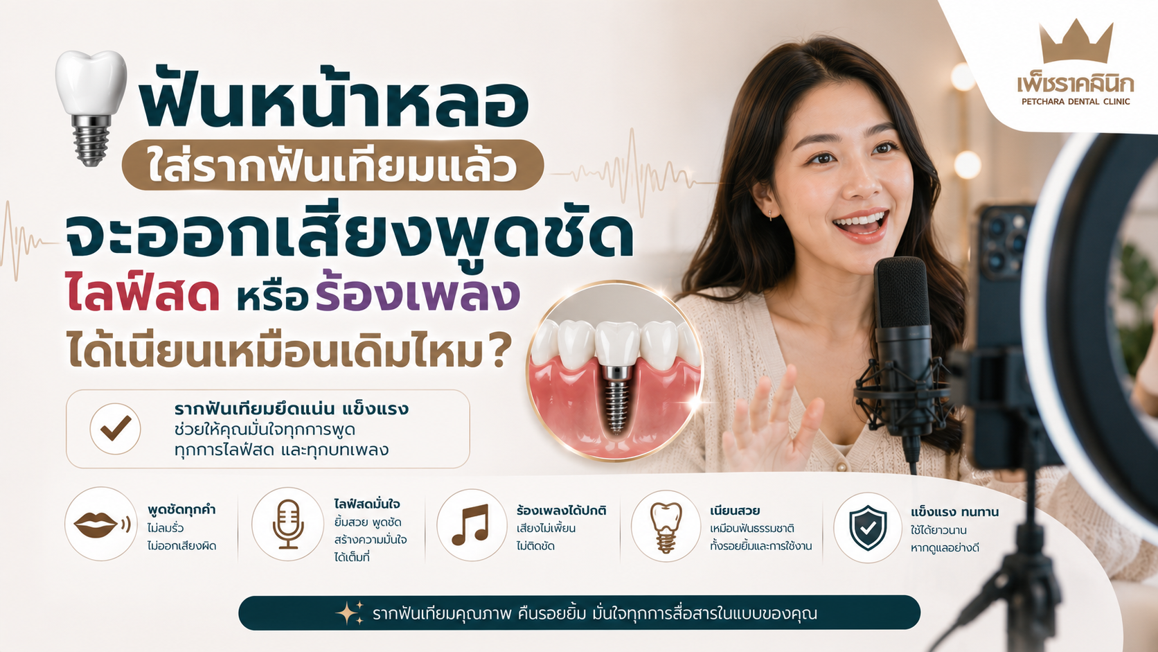 dental-implant-front-teeth-phonetics-speaking-guide