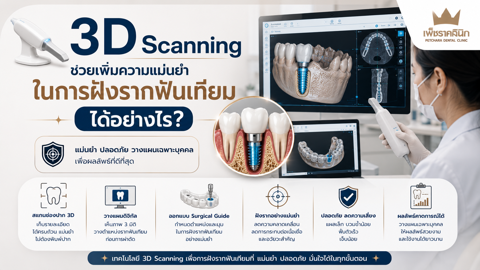 ai-3d-scanning-digital-guided-dental-implant-guide