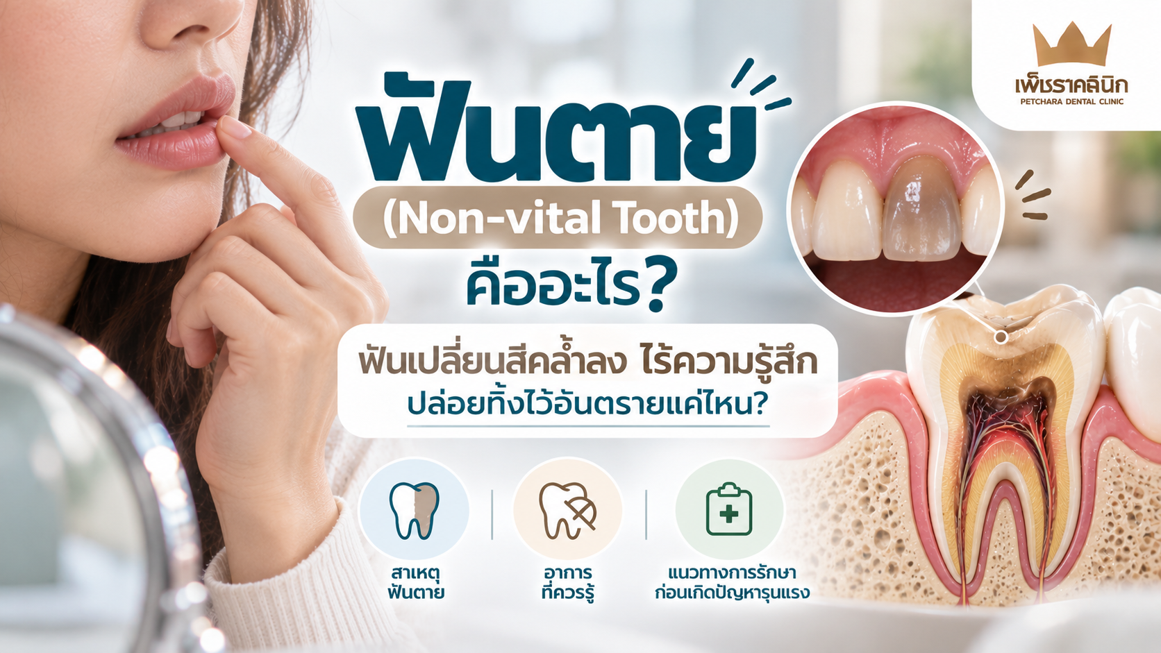 non-vital-tooth-symptoms-dangers-treatment