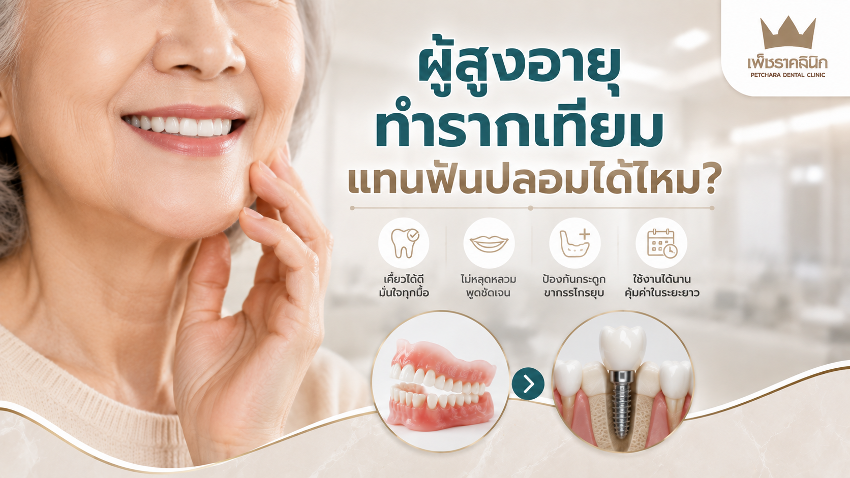 can-elderly-get-dental-implants-instead-of-dentures-guide