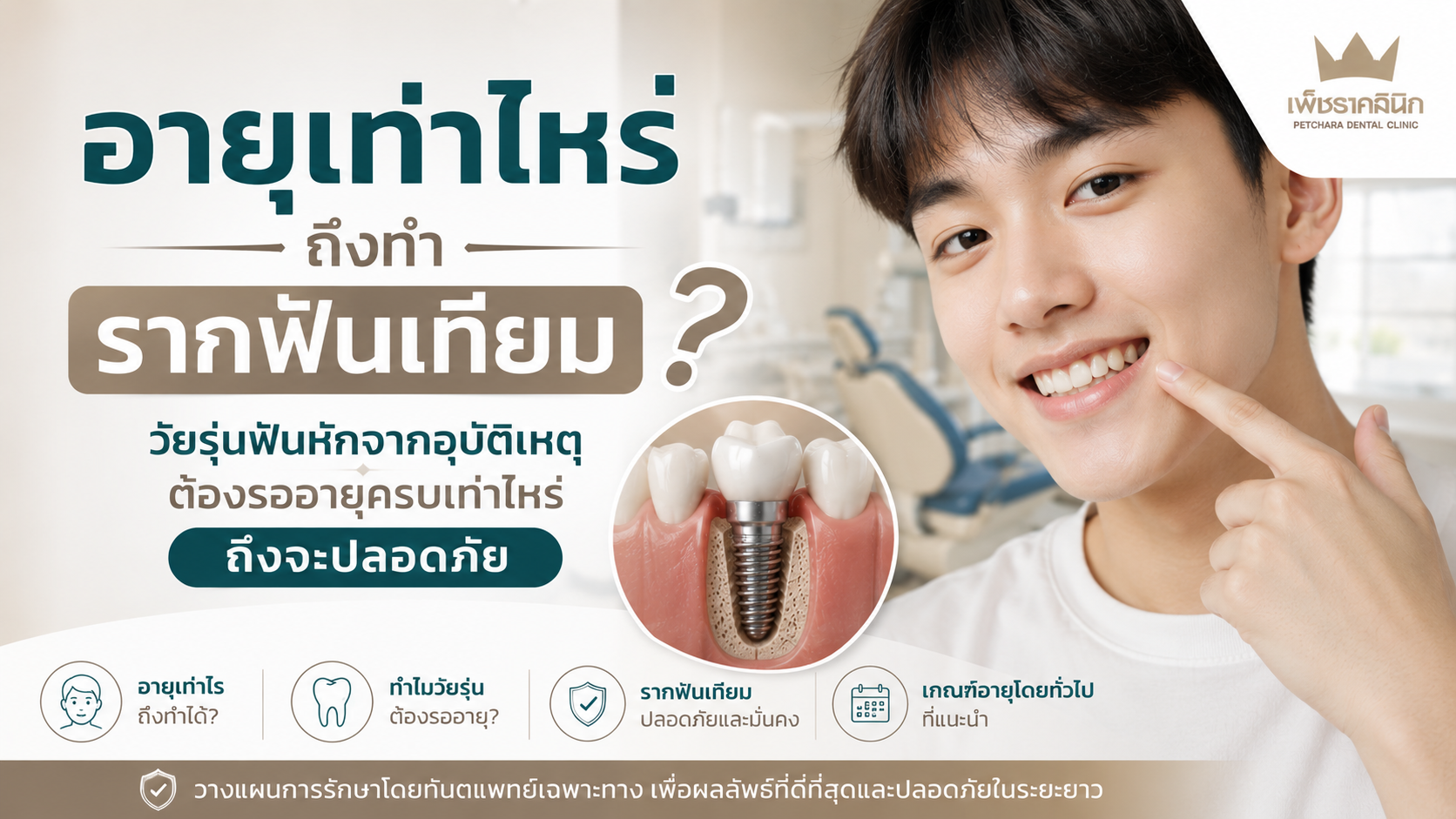 minimum-age-for-dental-implant