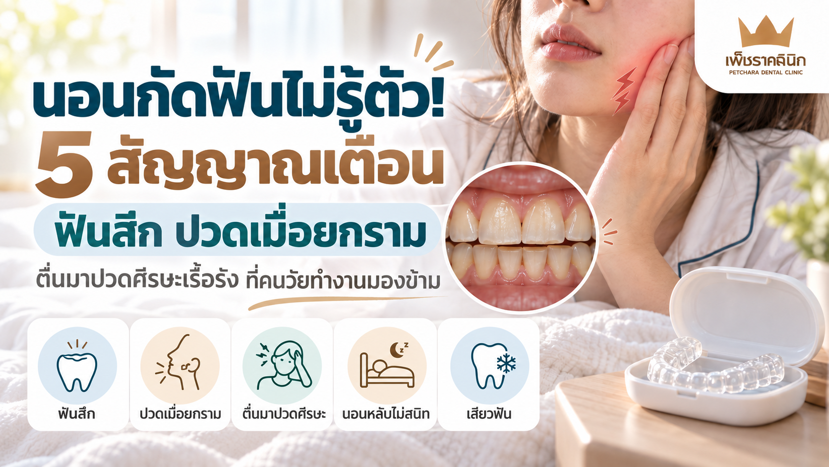 bruxism-teeth-grinding-night-guard-guide
