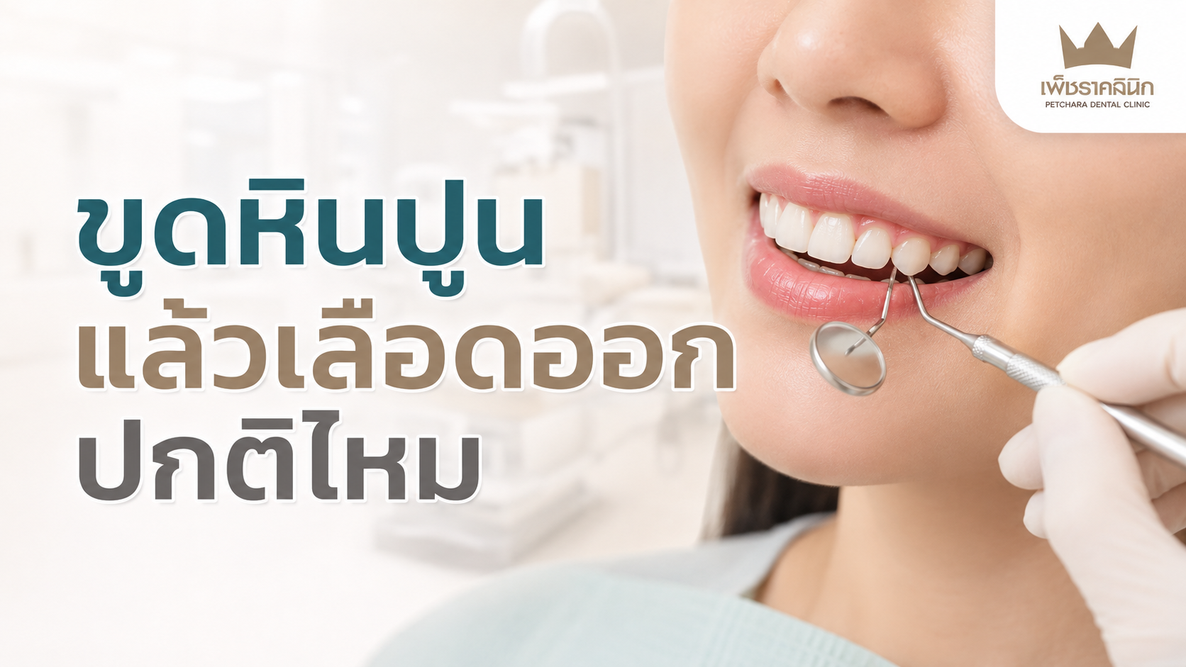 bleeding-after-scaling-is-it-normal-causes-and-care-guide