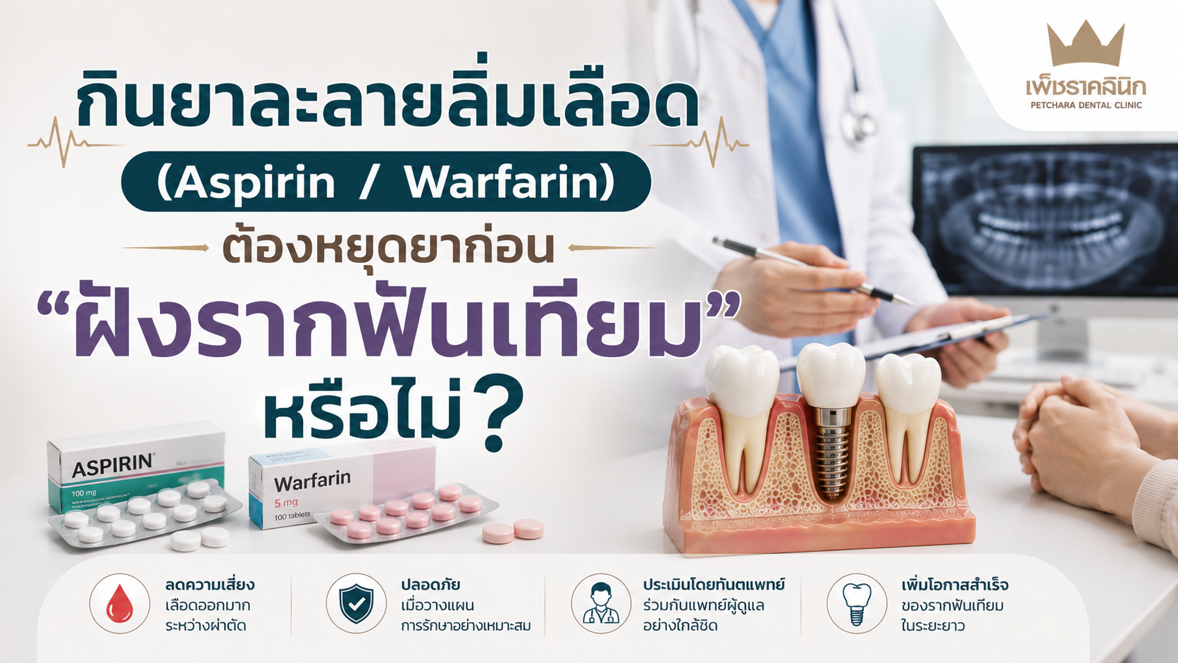 taking-blood-thinners-before-dental-implant
