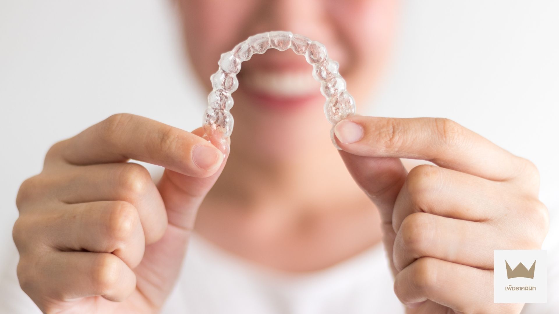 เปรียบเทียบ จัดฟันใส Invisalign กับจัดฟันโลหะทั่วไป แบบไหนเหมาะกับคุณ?