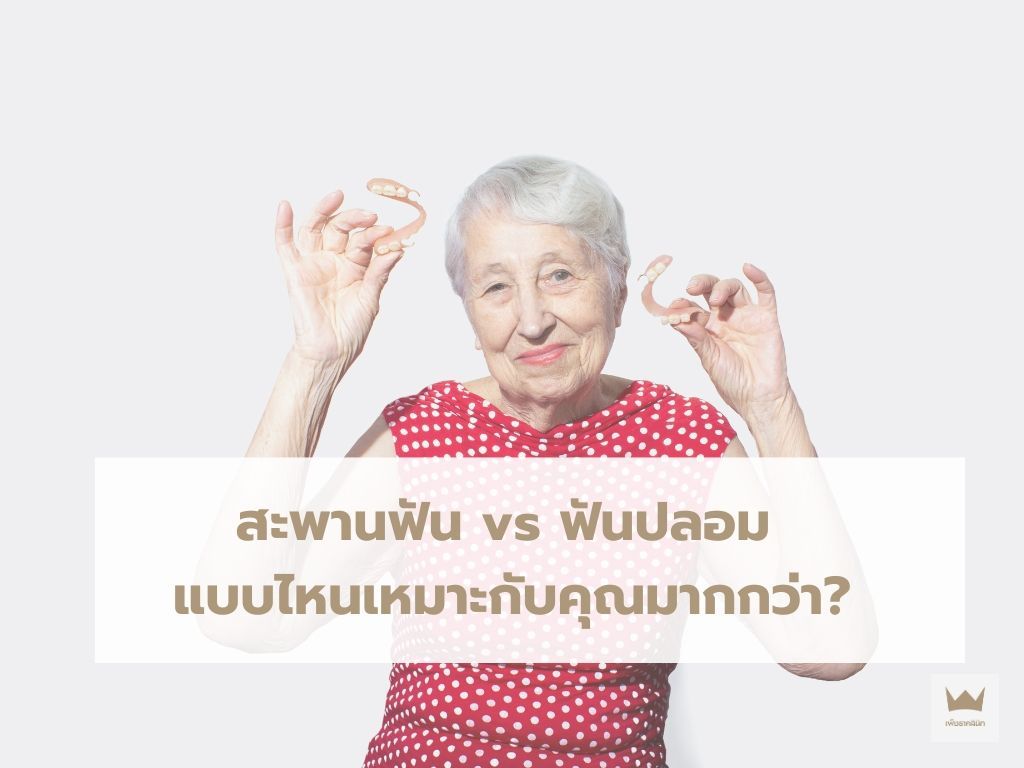 สะพานฟัน vs ฟันปลอม: แบบไหนเหมาะกับคุณมากกว่า?