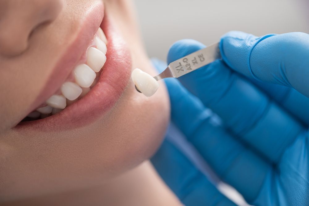 ทำครอบฟัน (Dental Crown) เจ็บไหม? ขั้นตอนและวิธีดูแลตัวเอง