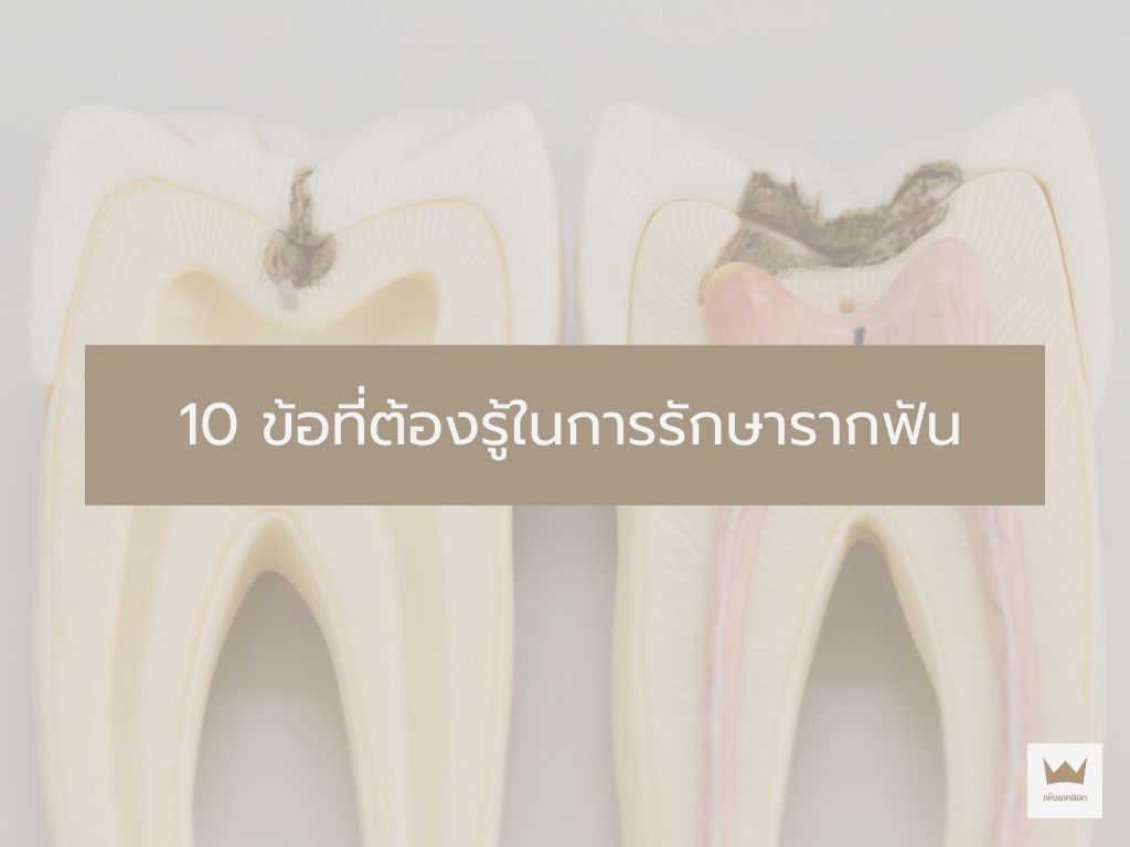 การรักษารากฟัน (Root Canal Treatment) 
