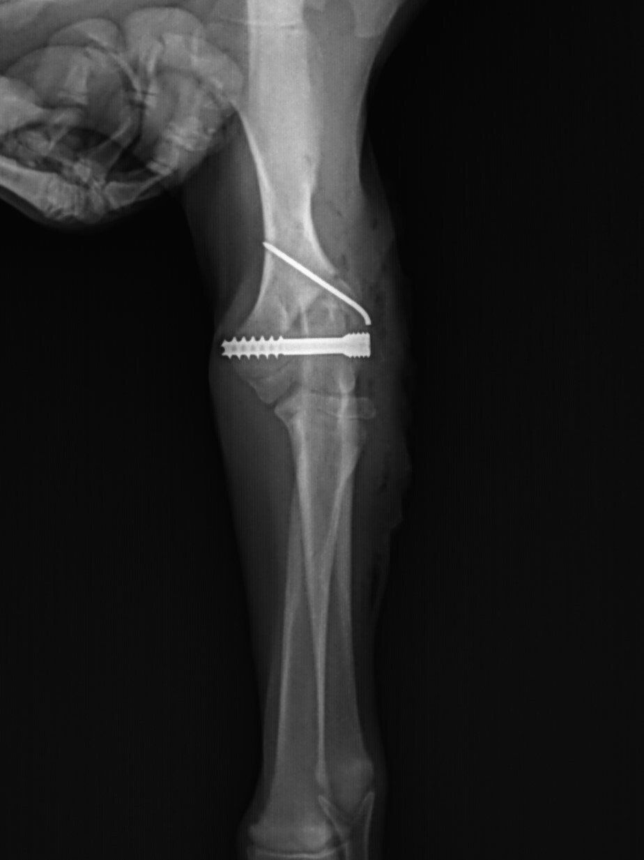 AAH elbow fracture repair radiograph