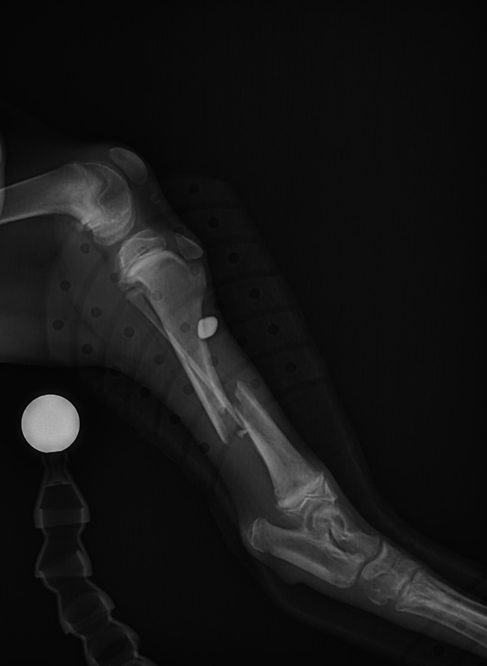 AAH fractured tibia radiograph