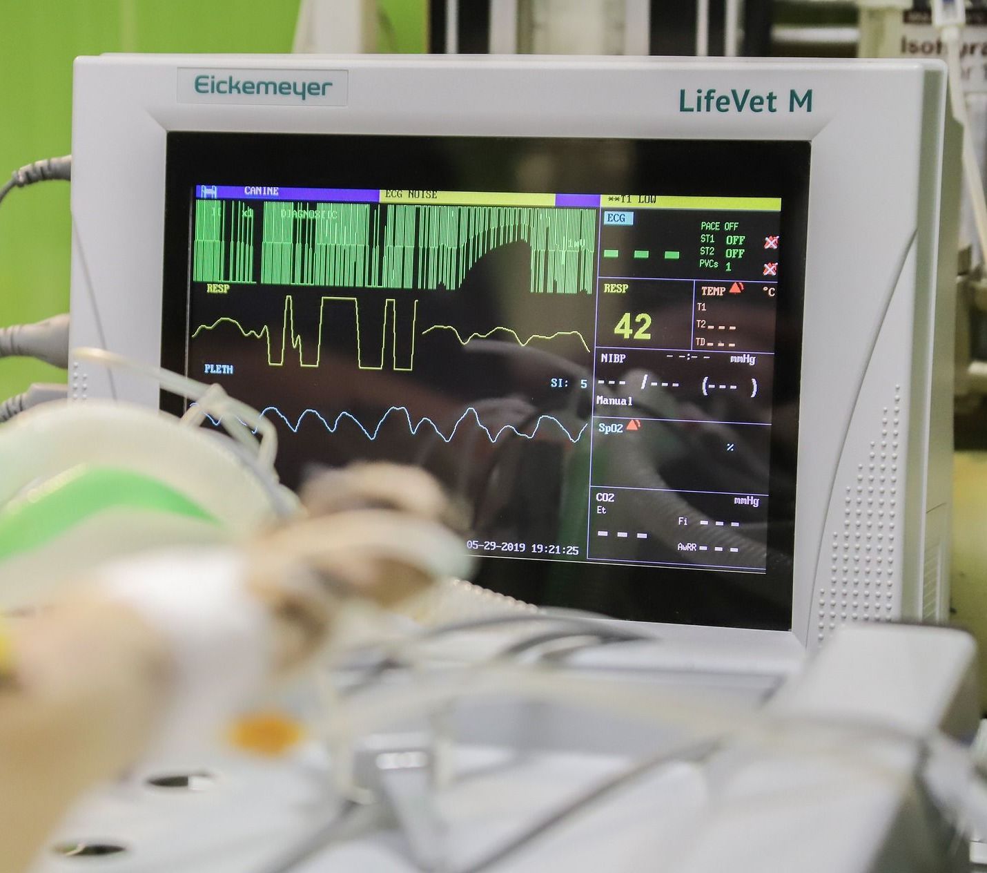 anesthetic monitoring