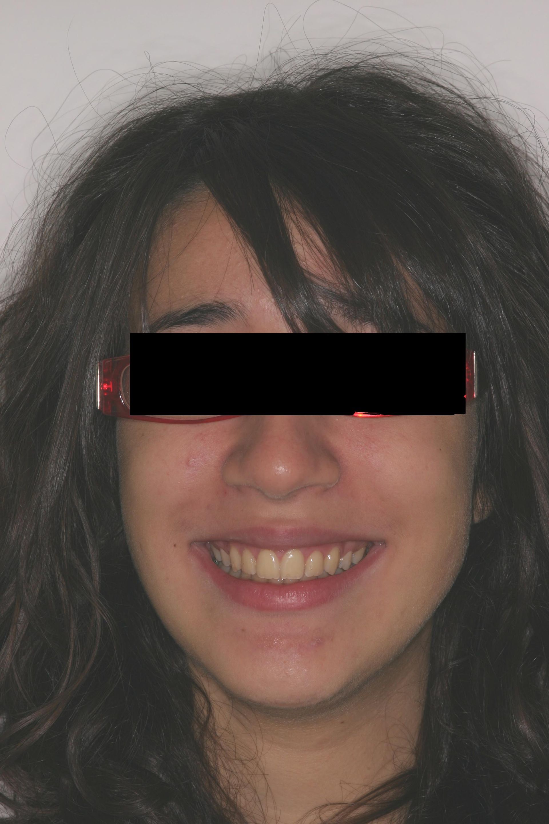 viso post trattamento c.e.