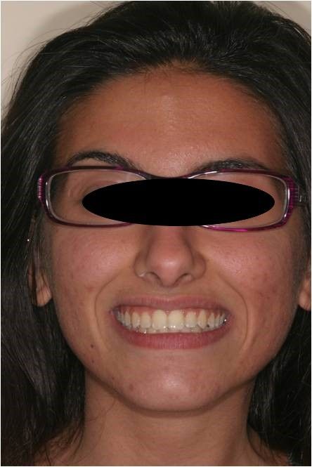 viso post trattamento s.c.