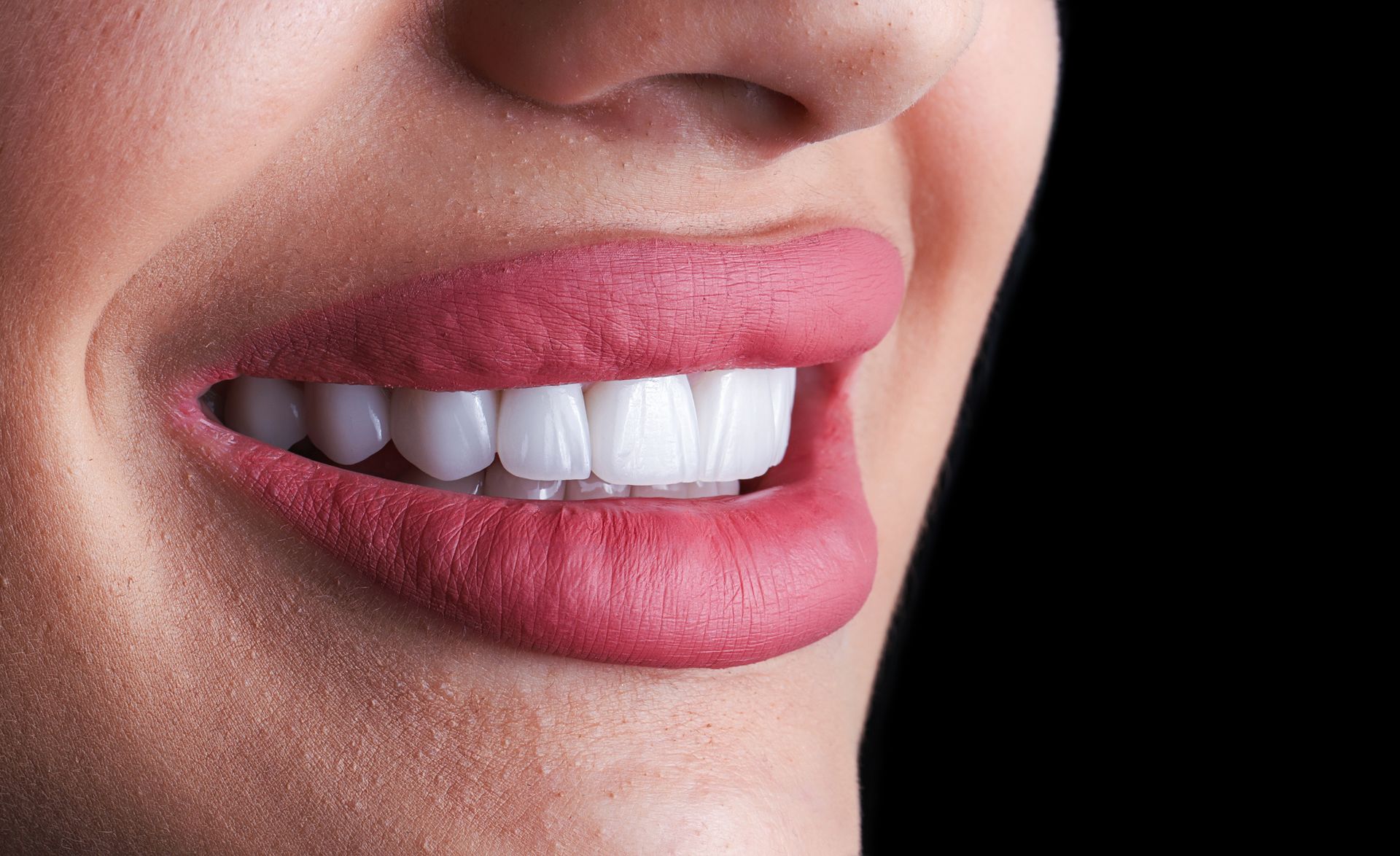 Radiant red lips paired with flawless ceramic veneer teeth.
