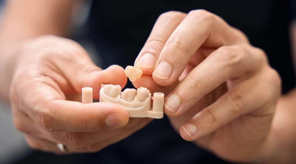 Hands holding a small dental mold with artificial teeth.