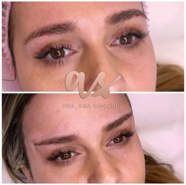 A before and after picture of a woman 's eyebrows.