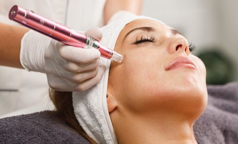 A woman is getting a microdermabrasion treatment on her face.