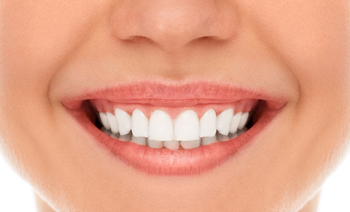 A close up of a woman 's mouth with white teeth.
