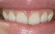 Close-up of a smiling mouth showing white teeth and pink lips