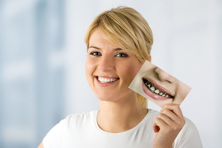 Smiling person holding a dental before-and-after photo against a light background