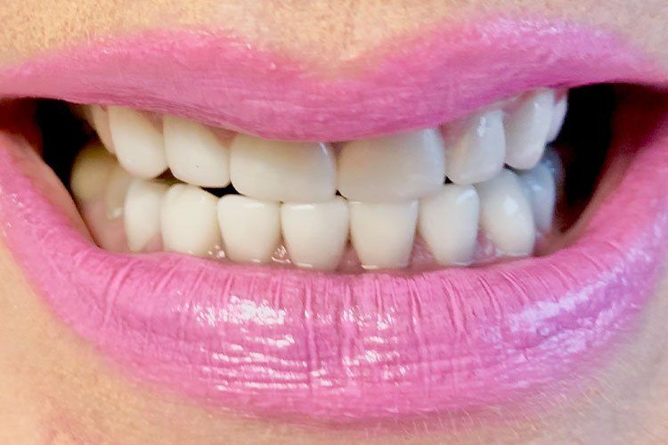 Close-up of smiling mouth with glossy pink lipstick and white teeth