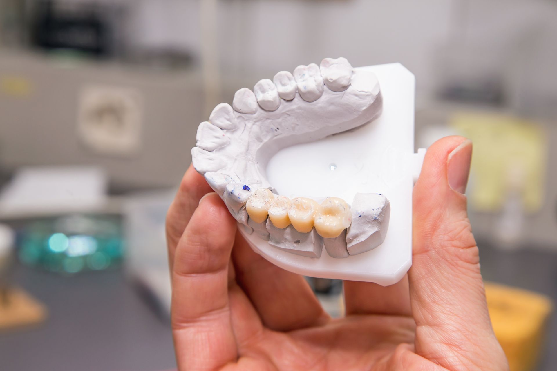 Hand holding a dental mold with upper and lower teeth impressions on a white base
