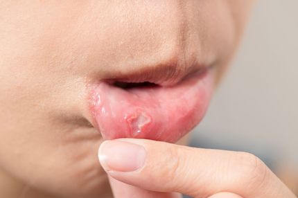 oral surgery