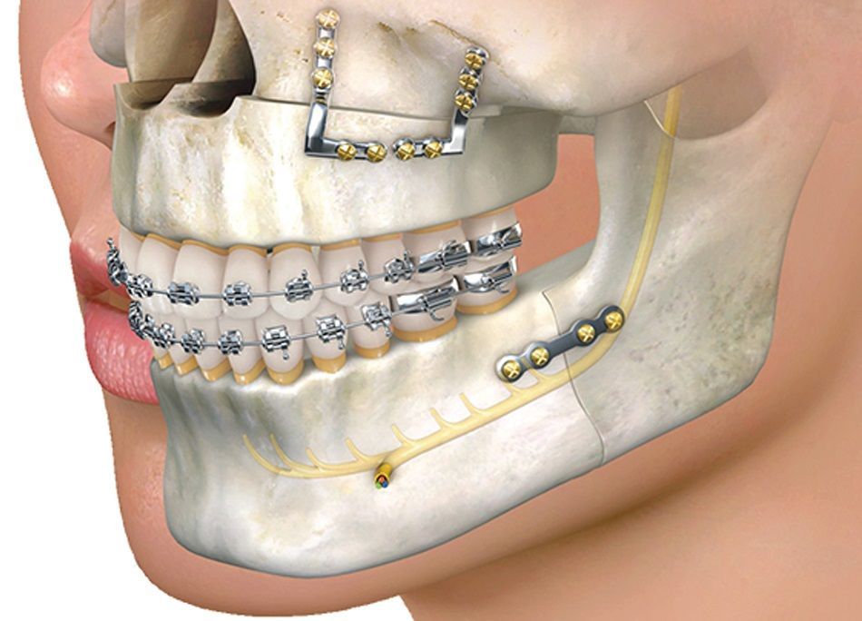 oral surgery
