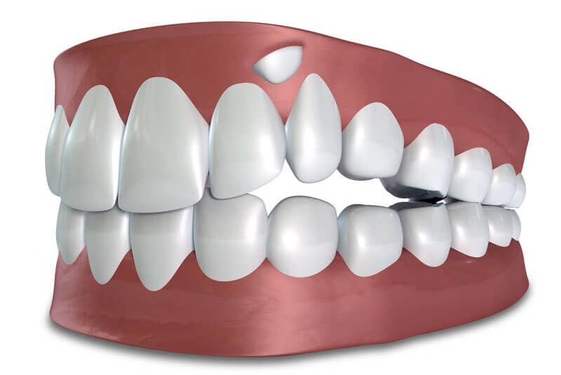 oral surgery