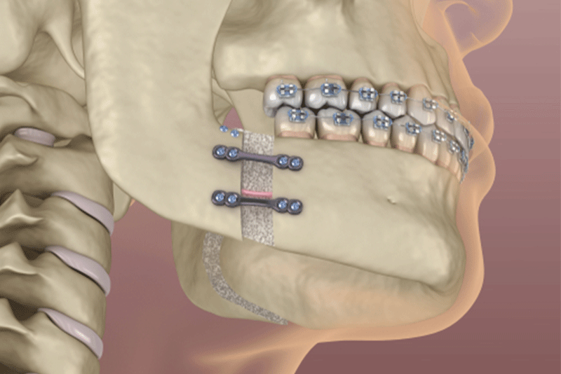 oral surgery