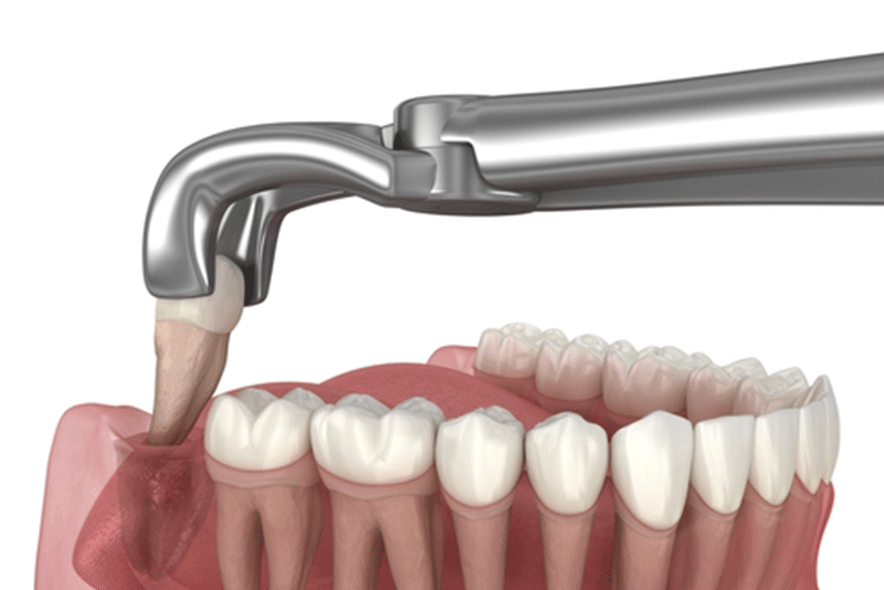 oral surgery