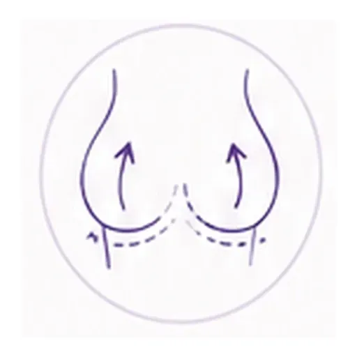 Line drawing of breasts with arrows pointing upward, suggesting lift or support.