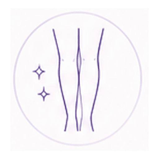 Illustration of liposuction treatment areas on the thighs, calves and ankles