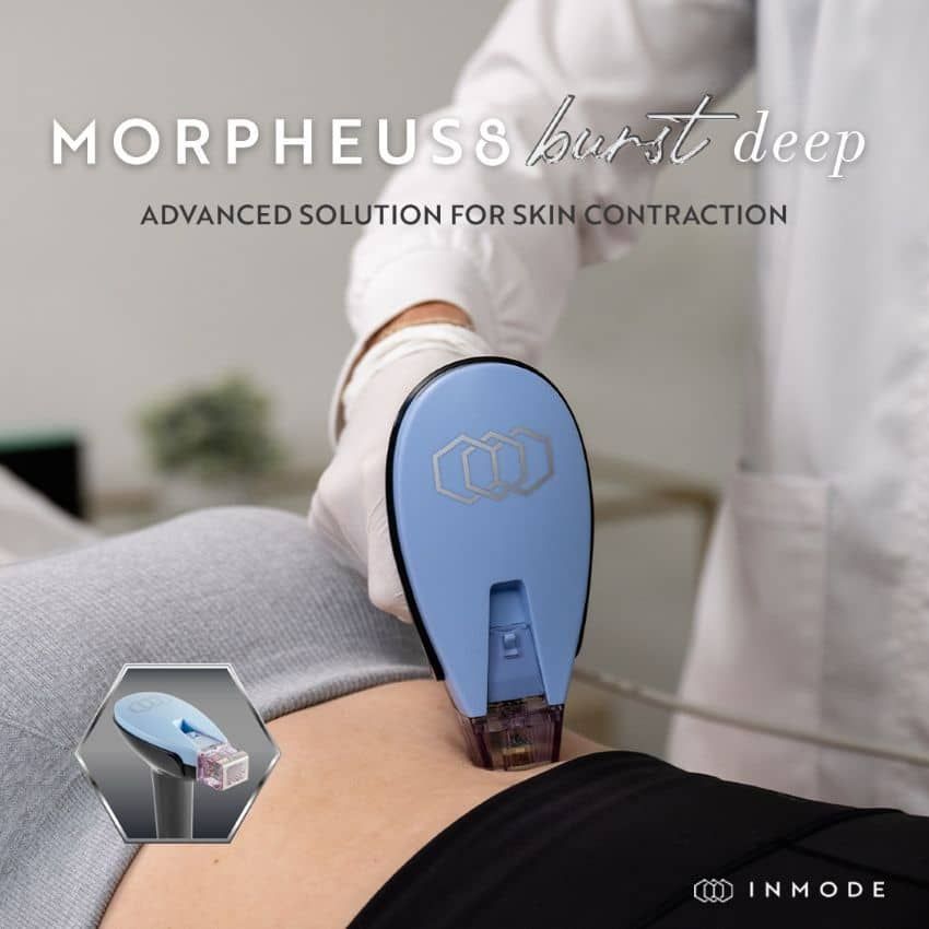 Morpheus8 Burst Deep applicator technology