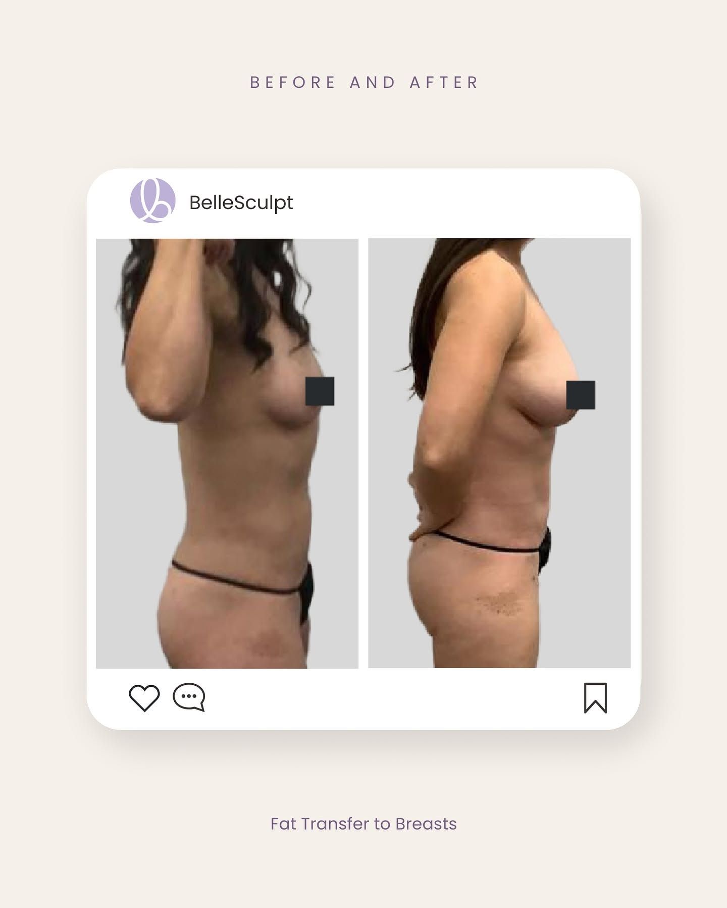 Side-by-side side profile photos showing before-and-after body shape comparison.
