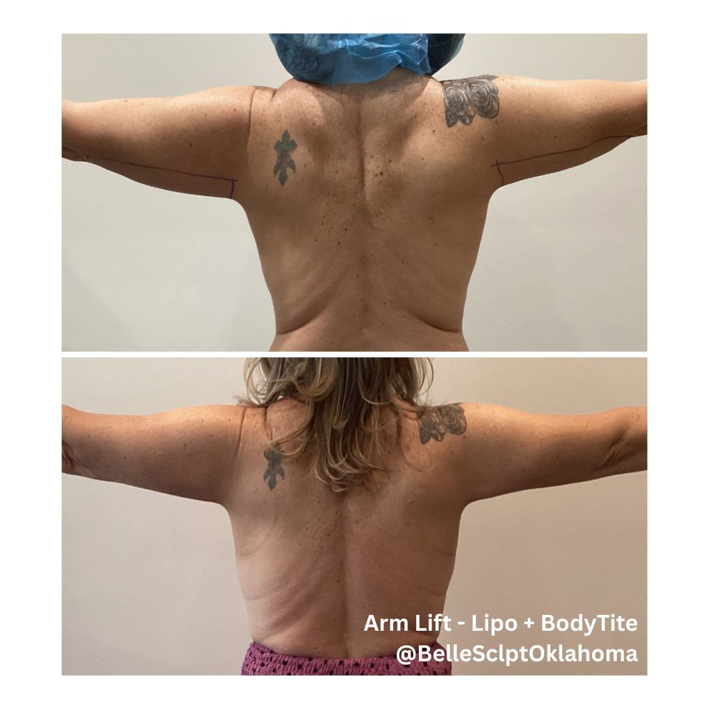 Two back views showing arm lifts and body tie differences; tattooed shoulders, one with blue head covering.