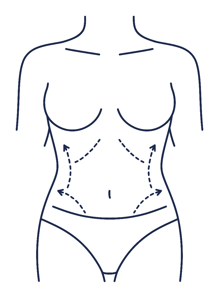 Front view outline of a torso with dashed lines marking the waist and abdomen.