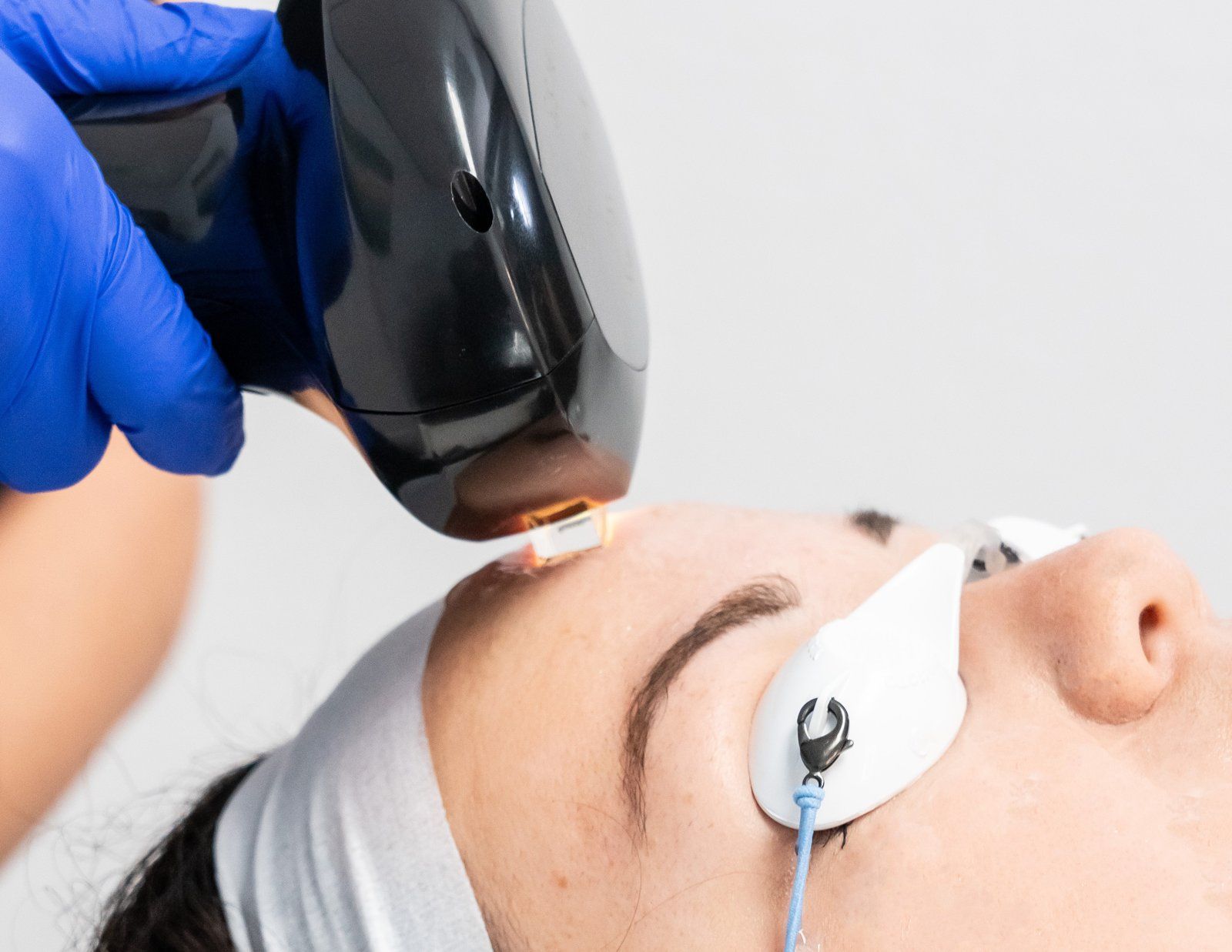 A provider treating a patient's forehead with the Lumecca IPL handpiece while her eyes are shielded