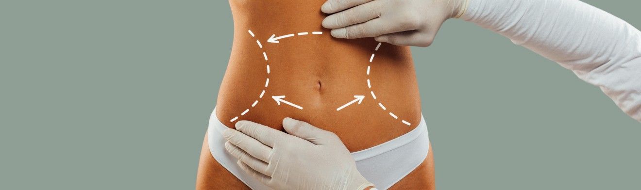 Liposuction body-contouring treatment