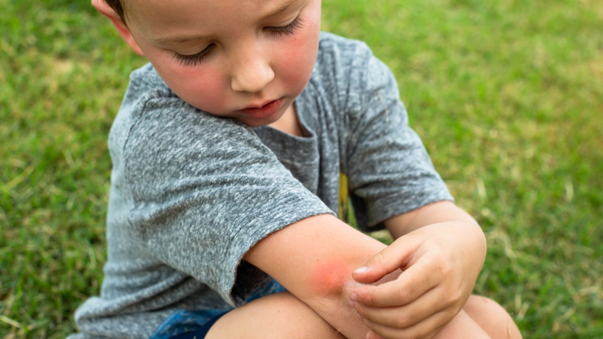 A young boy is sitting on the grass scratching his arm.