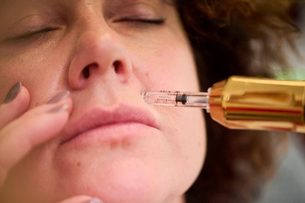 Eine Frau bekommt eine Botox-Injektion in die Lippen.
