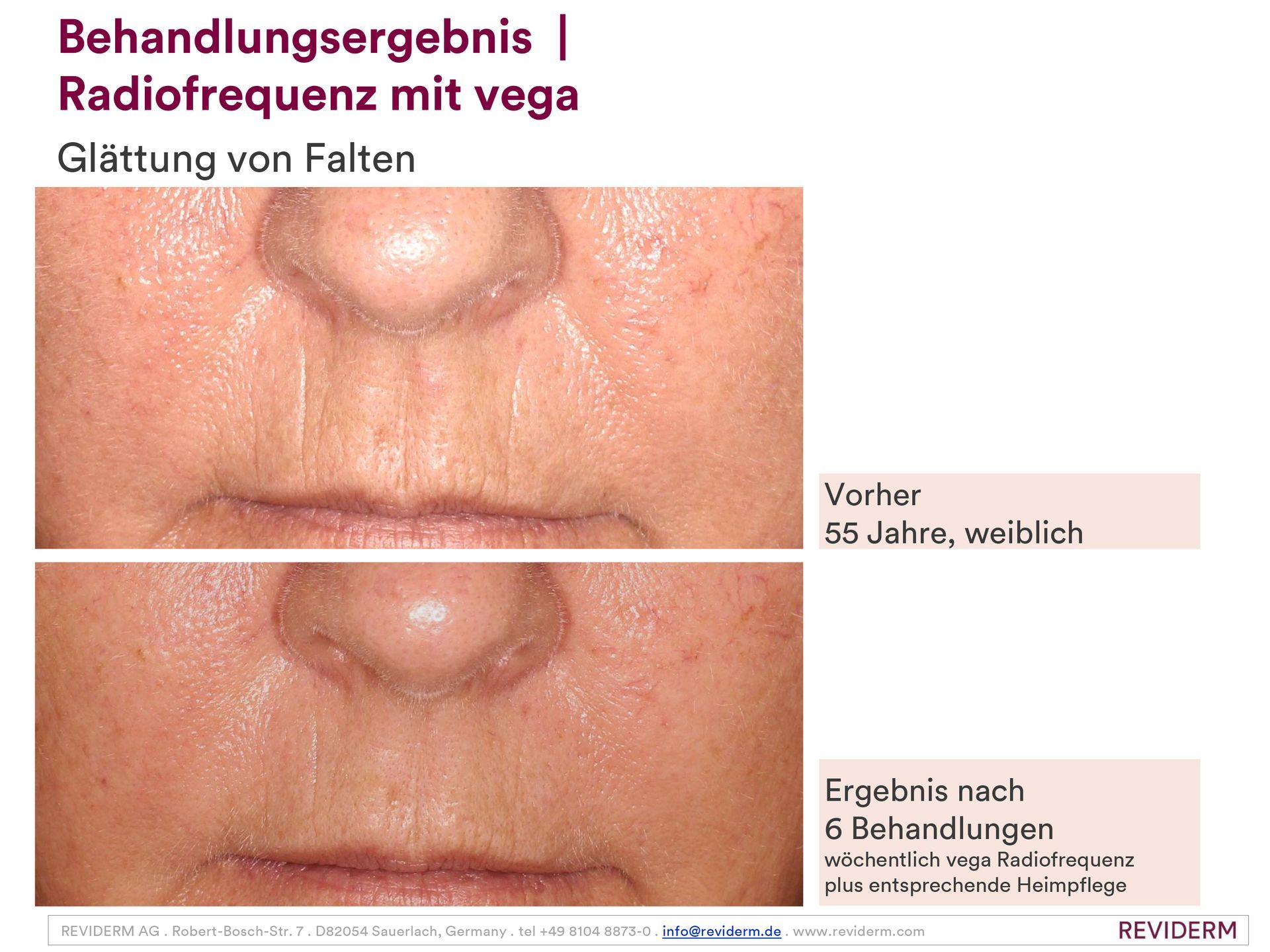 Ein Vorher-Nachher-Bild des Gesichts einer Frau